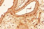 Cofilin Antibody in Immunohistochemistry (Paraffin) (IHC (P))