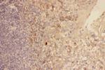 CXCR3 Antibody in Immunohistochemistry (Paraffin) (IHC (P))