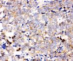 IKK alpha Antibody in Immunohistochemistry (Paraffin) (IHC (P))