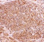 NFkB p52/p100 Antibody in Immunohistochemistry (Paraffin) (IHC (P))