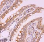 NFkB p52/p100 Antibody in Immunohistochemistry (Paraffin) (IHC (P))