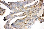 gamma Catenin Antibody in Immunohistochemistry (Paraffin) (IHC (P))