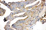 gamma Catenin Antibody in Immunohistochemistry (Paraffin) (IHC (P))