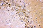 GluR1 Antibody in Immunohistochemistry (Paraffin) (IHC (P))