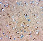 GluR1 Antibody in Immunohistochemistry (Paraffin) (IHC (P))