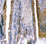 KCNMA1 Antibody in Immunohistochemistry (Paraffin) (IHC (P))