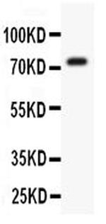 KV4.3 (KCND3) Antibody in Western Blot (WB)