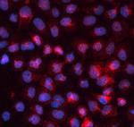 Transferrin Receptor Antibody in Immunocytochemistry (ICC/IF)