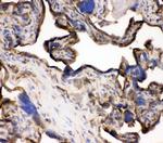 Transferrin Receptor Antibody in Immunohistochemistry (Frozen) (IHC (F))