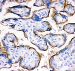 Transferrin Receptor Antibody in Immunohistochemistry (Paraffin) (IHC (P))