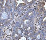 SERPINH1 Antibody in Immunohistochemistry (Paraffin) (IHC (P))