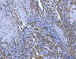 SERPINH1 Antibody in Immunohistochemistry (Paraffin) (IHC (P))