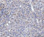 SERPINH1 Antibody in Immunohistochemistry (Paraffin) (IHC (P))