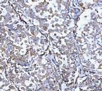 SERPINH1 Antibody in Immunohistochemistry (Paraffin) (IHC (P))