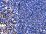 SERPINH1 Antibody in Immunohistochemistry (Paraffin) (IHC (P))