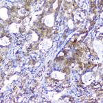 PRDX6 Antibody in Immunohistochemistry (Paraffin) (IHC (P))