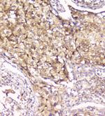 PRDX6 Antibody in Immunohistochemistry (Paraffin) (IHC (P))