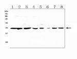 PRDX6 Antibody in Western Blot (WB)