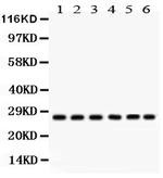 Calmyrin Antibody in Western Blot (WB)