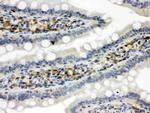 STAT1 Antibody in Immunohistochemistry (Paraffin) (IHC (P))