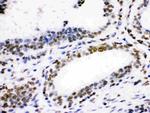 CDK1 Antibody in Immunohistochemistry (Paraffin) (IHC (P))