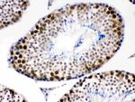 CDK1 Antibody in Immunohistochemistry (Paraffin) (IHC (P))