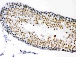 CDK1 Antibody in Immunohistochemistry (Paraffin) (IHC (P))