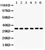 CDK1 Antibody in Western Blot (WB)