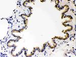 COMT Antibody in Immunohistochemistry (Paraffin) (IHC (P))