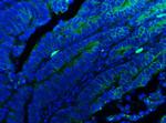 E-cadherin Antibody in Immunohistochemistry (IHC)