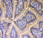 E-cadherin Antibody in Immunohistochemistry (Frozen) (IHC (F))