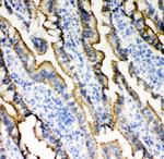 E-cadherin Antibody in Immunohistochemistry (Frozen) (IHC (F))