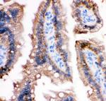 E-cadherin Antibody in Immunohistochemistry (Paraffin) (IHC (P))