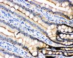 E-cadherin Antibody in Immunohistochemistry (Paraffin) (IHC (P))