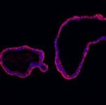 E-cadherin Antibody in Immunohistochemistry (Paraffin) (IHC (P))