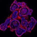 E-cadherin Antibody in Immunohistochemistry (Paraffin) (IHC (P))