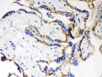 E-cadherin Antibody in Immunohistochemistry (IHC)