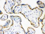 E-cadherin Antibody in Immunohistochemistry (IHC)