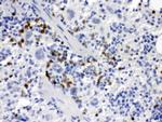 M-CSF Antibody in Immunohistochemistry (Paraffin) (IHC (P))