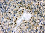 EphB1 Antibody in Immunohistochemistry (Paraffin) (IHC (P))