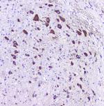 HTR2A Antibody in Immunohistochemistry (Paraffin) (IHC (P))