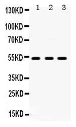 HTR2A Antibody in Western Blot (WB)