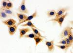 IDH1 Antibody in Immunocytochemistry (ICC/IF)