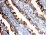 IDH1 Antibody in Immunohistochemistry (Frozen) (IHC (F))