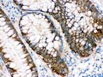 IDH1 Antibody in Immunohistochemistry (Paraffin) (IHC (P))