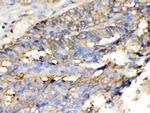 Cofilin Antibody in Immunohistochemistry (Paraffin) (IHC (P))