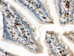 Cofilin Antibody in Immunohistochemistry (Paraffin) (IHC (P))