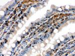 Cofilin Antibody in Immunohistochemistry (Paraffin) (IHC (P))