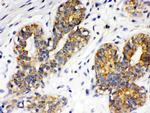 ITGA4 Antibody in Immunohistochemistry (Paraffin) (IHC (P))