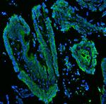 Cytokeratin 19 Antibody in Immunohistochemistry (Paraffin) (IHC (P))